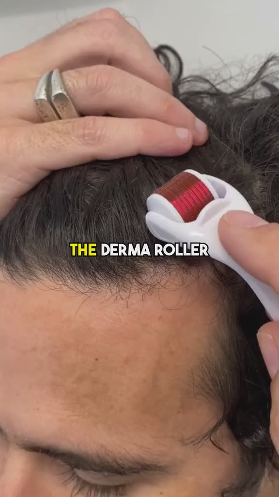 Titanium Derma Roller for Face, Hair, Scalp & Beard | 540 Microneedle Skin Care Tool (0.25mm–3.0mm)